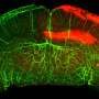 A new therapeutic target for traumatic brain injury