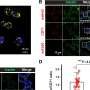 Experimental drug shields pancreas from type 1 diabetes attack