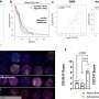 Genetically engineering a treatment for incurable brain tumors