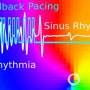 Gentle defibrillation for the heart: A milder method developed by researchers for cardiac arrhythmias