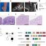 Protein responsible for genetic inflammatory disease identified