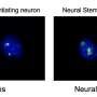 Study uncovers the mechanism that avoids conflicts in the activity of brain stem cells