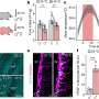 Unraveling the neural circuit behind reduced food intake in high temperatures