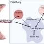 New research seeks to determine whether cystic fibrosis can be treated in utero