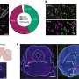 Study shows two neural pathways involved in fentanyl addiction