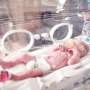 Pandemic health behaviors linked to rise in neonatal health issues