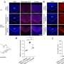 Pulsed field ablation procedures found safe and effective for atrial fibrillation patients