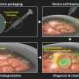 Self-deployable, biodegradable electrode offers minimally invasive brain signal monitoring