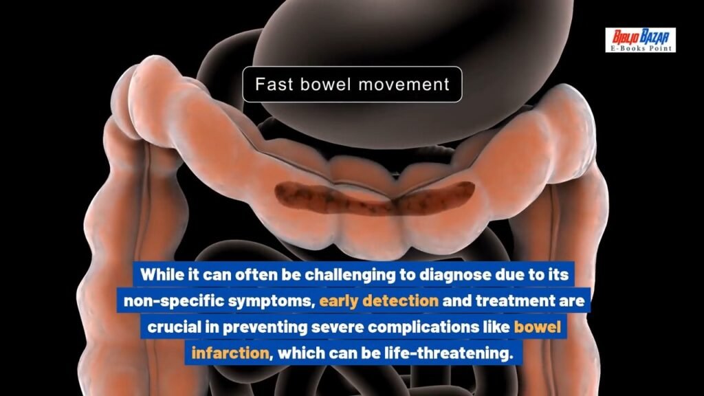 Chronic Mesenteric Ischemia Explained: Causes, Symptoms & Treatment Options 🚨 | Nursing Care Plan & Surgery”