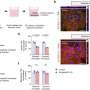 Gut reaction: Low levels of manganese can aggravate inflammatory bowel disease