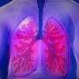 Combination treatment improves response to immunotherapy for lung cancer, mouse study shows