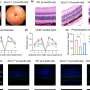 DNA damage is key factor in age-related macular degeneration, study finds