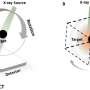 Single X-ray projection achieves 3D imaging, reducing radiation exposure