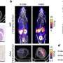 Scientists develop scans that light up aggressive cancer tumors for better treatment